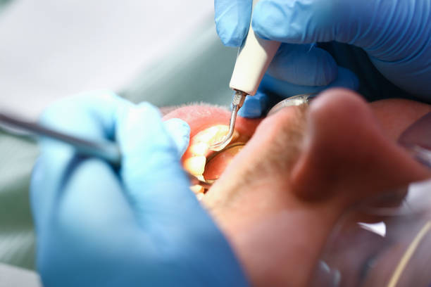 Best Emergency Denture Repair in Concordia, MO